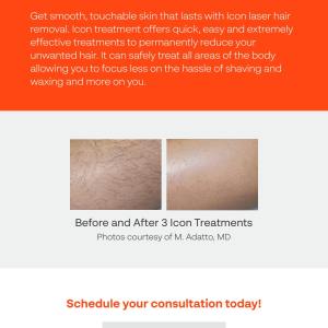 Laser Hair removal process.